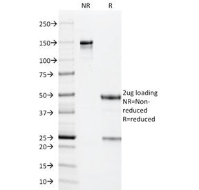 SDS-PAGE analysis of purified, BSA-free PP65 antibody (clone CMV101) as confirmation of integrity and purity.