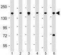 Western blot testing of human 1) 293T/17, 2) DU-145, 3) LNCaP, 4) Raji, 5) U-2OS and 6) HeLa cell lysate with PDS5B antibody at 1:2000. Predicted molecular weight: 165 kDa.