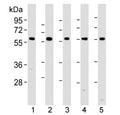Western blot analysis of lysate from 1) human HeLa, 2) human A549, 3) mouse NIH3T3, 4) mouse C2C12, and 5) rat PC-12 lysate using PKM2 antibody at 1:1000. Predicted molecular weight ~58 KDa.