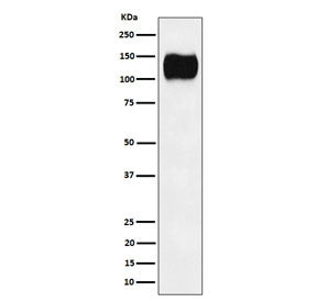 Western blot testing of human Ramos cell lysate with ICAM3 antibody. Observed molecular weight: 60~120 kDa depending on glycosylation level.