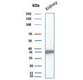 Western blot testing of human kidney tissue lysate with recombinant Napsin A antibody. Expected molecular weight: 38-45 kDa.