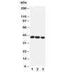 Western blot testing of CCR4 antibody and Lane 1: rat thymus; 2: rat spleen; 3: mouse HEPA cell lysate. Predicted/observed molecular weight: ~41 kDa.