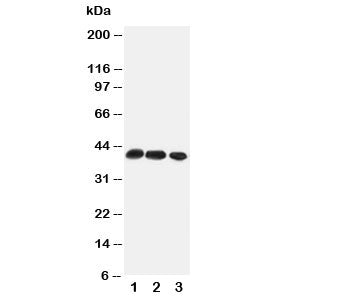 Western blot testing of CCR4 antibody and Lane 1: rat thymus; 2: rat spleen; 3: mouse HEPA cell lysate. Predicted/observed molecular weight: ~41 kDa.