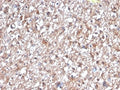 IHC staining of FFPE human brain tissue with PKC iota antibody (clone PRKCI/4912). HIER: boil tissue sections in pH 9 10mM Tris with 1mM EDTA for 20 min and allow to cool before testing.