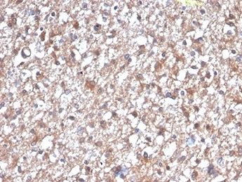 IHC staining of FFPE human brain tissue with PKC iota antibody (clone PRKCI/4912). HIER: boil tissue sections in pH 9 10mM Tris with 1mM EDTA for 20 min and allow to cool before testing.