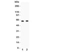 Western blot testing of HEXB antibody and Lane 1: HeLa; 2: HEPG2 lysate. Predicted/observed size ~63KD