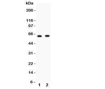 Western blot testing of HEXB antibody and Lane 1: HeLa; 2: HEPG2 lysate. Predicted/observed size ~63KD