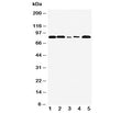 Western blot testing of FGFR1 antibody and Lane 1: rat liver; 2: rat brain; 3: SMMC-7721; 4: HT1080; 5: MM231 cell lysate. Predicted molecular weight: 75-160 kDa depending on glycosylation level.