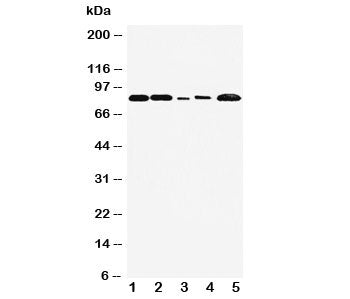 Western blot testing of FGFR1 antibody and Lane 1: rat liver; 2: rat brain; 3: SMMC-7721; 4: HT1080; 5: MM231 cell lysate. Predicted molecular weight: 75-160 kDa depending on glycosylation level.