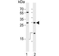Western blot testing of human 1) NCI-H1299 and 2) Raji cell lysate with HLA-DRB1 antibody. Predicted molecular weight ~30 kDa.