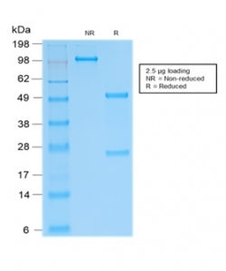 SDS-PAGE analysis of purified, BSA-free recombinant SOX9 antibody (clone SOX9/2287R) as confirmation of integrity and purity.
