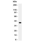 Western blot testing of Cathepsin G antibody and rat thymus lysate. Predicted molecular weight ~29 kDa, can be observed at ~36 kDa.