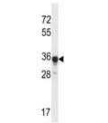 ABHD4 antibody western blot analysis in mouse kidney tissue lysate. Predicted molecular weight ~39 kDa.