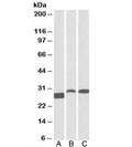 Western blot testing of A) human tonsil, B) rat spleen, C) pig spleen lysates with APRIL antibody at 0.1ug/ml. Predicted molecular weight: ~28kDa.