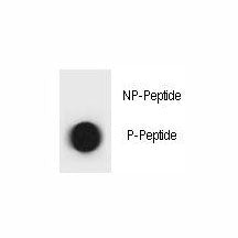 Dot blot analysis of phospho-TSC1 antibody. 50ng of phos-peptide or nonphos-peptide per dot were spotted.