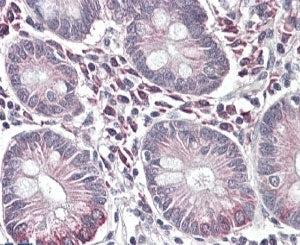 IHC testing of FFPE human small intestine with SLC10A2 antibody at 4ug/ml. HIER: steamed with pH6 citrate buffer, AP-staining. Staining of cells in the laminia propria between the intestinal vili is seen.