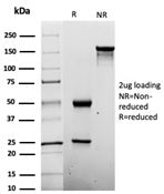 SDS-PAGE analysis of purified, BSA-free Penicillin antibody (clone Pen-9) as confirmation of integrity and purity.