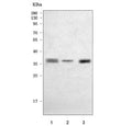 Western blot testing of 1) human U-251, 2) human 293T and 3) rat PC-12 cell lysate with SOX2 antibody. Predicted molecular weight ~34 kDa.