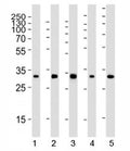 Western blot analysis of lysate from 1) 293, 2) HeLa, 3) mouse NIH3T3, 4) rat PC-12 and 5) rat brain tissue using RPS6 antibody at 1:2000. Predicted molecular weight ~29 kDa.