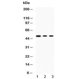 Western blot testing of 1) rat thymus, 2) human HepG2 and 3) human MCF7 lysate with PRKAR1A antibody at 0.5ug/ml. Predicted molecular weight ~48 kDa.