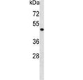 Western blot testing of human HepG2 cell lysate with PHKG2 antibody. Predicted molecular weight ~44 kDa.
