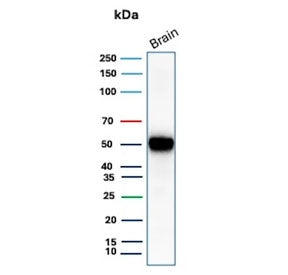 Western blot testing of human brain tissue lysate with GFAP antibody (clone GFAP/9421). Predicted molecular weight ~50 kDa.