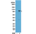 Western blot of A431 cell lysate, untreated (-) or treated (+) with EGF, using recombinant phospho-Stat3 antibody at 1:1000.