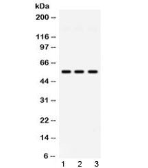 Western blot testing of 1) rat testis, 2) mouse testis and 3) human HeLa lysate with PIAS4 antibody at 0.5ug/ml. Predicted/observed molecular weight ~57 kDa.