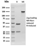 SDS-PAGE analysis of purified, BSA-free recombinant CD79b antibody (rIGB/1842) as confirmation of integrity and purity.