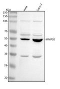 Western blot analysis of MMP20 using anti-MMP20 antibody. Lane 1: human Hela whole cell lysates, Lane 2: human Caco-2 whole cell lysates. After electrophoresis, proteins were transferred to a nitrocellulose membrane at 150 mA for 50-90 min. Blocked the membrane with 5% non-fat milk/TBS for 1.5 hour at RT.