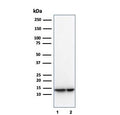 Western blot testing of human 1) LNCaP and 2) PC3 cell lysates using MIF antibody (clone MIF/3489). Predicted molecular weight ~13 kDa.