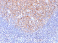 IHC testing of FFPE human tonsil with CD81 antibody (clone 1.3.3.22). Required HIER: boil tissue sections in 10mM citrate buffer, pH 6, for 10-20 min followed by cooling at RT for 20 min.