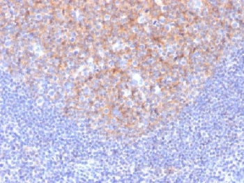 IHC testing of FFPE human tonsil with CD81 antibody (clone 1.3.3.22). Required HIER: boil tissue sections in 10mM citrate buffer, pH 6, for 10-20 min followed by cooling at RT for 20 min.