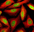 Immunofluorescent staining of SLF2 using anti-SLF2 antibody (green) and anti-Beta Tubulin antibody (red). SLF2 was detected in an immunocytochemical section of U2OS cells. Enzyme antigen retrieval was performed using IHC enzyme antigen retrieval reagent for 15 mins. The cells were blocked with 10% goat serum. And then incubated with 5 ug/ml rabbit anti-SLF2 antibody and mouse anti-Beta Tubulin antibody overnight at 4oC.