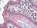 IHC testing of FFPE human colon with SLC12A2 antibody at 4ug/ml. HIER: steamed with pH6 citrate buffer, AP-staining.