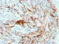 IHC testing of FFPE human small intestine with recombinant Elastin antibody (clone ELN/3131R). Required HIER: boiling tissue sections in 10mM citrate buffer, pH 6, for 10-20 min and allow to cool prior to staining.