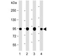 Western blot testing of 1) human HT-29, 2) human HepG2, 3) human COLO205 and 4) mouse colon lysate with VIL1 antibody. Predicted molecular weight ~93 kDa.
