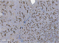 IHC staining of FFPE mouse kidney with Uromodulin antibody. HIER: boil tissue sections in pH8 EDTA for 20 min and allow to cool before testing.