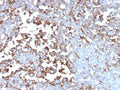 IHC staining of FFPE human adrenal gland tissue with Clusterin antibody (clone CLU/12059). HIER: boil tissue sections in pH 9 10mM Tris with 1mM EDTA for 20 min and allow to cool before testing.