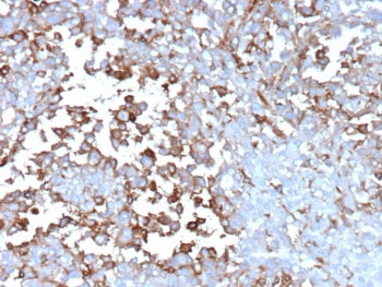 IHC staining of FFPE human adrenal gland tissue with Clusterin antibody (clone CLU/12059). HIER: boil tissue sections in pH 9 10mM Tris with 1mM EDTA for 20 min and allow to cool before testing.