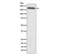 Western blot testing of human plasma lysate with Alpha-2-macroglobulin antibody. Expected molecular weight: 163-200 kDa depending on the level of glycosylation.