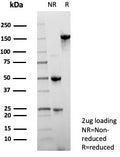SDS-PAGE analysis of purified, BSA-free NSE gamma antibody (clone ENO2/7447) as confirmation of integrity and purity.