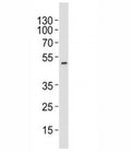 Western blot analysis of lysate from HT-29 cell line using AURKA antibody at 1:1000. Predicted molecular weight ~45 kDa.