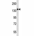 Anti-Insulin Receptor antibody western blot analysis in mouse liver tissue lysate. Expected molecular weight: ~156 kDa.