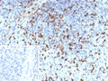 IHC staining of FFPE human spleen tissue with S100A4 antibody (clone S100A4/6796). Inset: PBS used in place of primary Ab (secondary Ab negative control). HIER: boil tissue sections in pH 9 10mM Tris with 1mM EDTA for 20 min and allow to cool before testing.