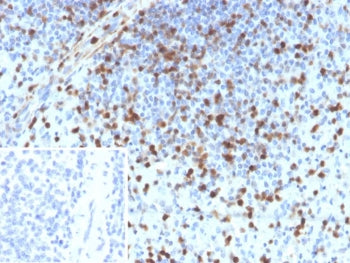 IHC staining of FFPE human spleen tissue with S100A4 antibody (clone S100A4/6796). Inset: PBS used in place of primary Ab (secondary Ab negative control). HIER: boil tissue sections in pH 9 10mM Tris with 1mM EDTA for 20 min and allow to cool before testing.