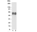 Western blot testing of RUNX2 antibody and Lane 1: rat thymus; 2: rat testis tissue lysate. Predicted molecular weight: 50-60 kDa.