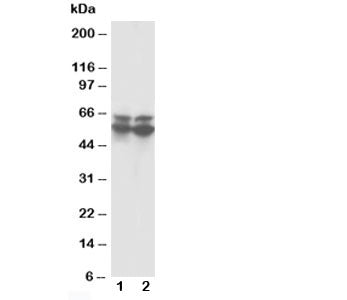 Western blot testing of RUNX2 antibody and Lane 1: rat thymus; 2: rat testis tissue lysate. Predicted molecular weight: 50-60 kDa.