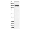 Western blot testing of human brain lysate with Collagen VI antibody. Predicted molecular weight ~109 kDa, routinely observed at 140-150 kDa.