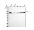 Western blot analysis of VGLUT2/SLC17A6 using anti-SLC17A6 antibody. Lane 1: human SH-SY5Y whole cell lysates, Lane 2: human U-87MG whole cell lysates, Lane 3: human U251 whole cell lysates, Lane 4: rat C6 whole cell lysates, Lane 5: mouse Neuro-2a whole cell lysates. After electrophoresis, proteins were transferred to a nitrocellulose membrane at 150 mA for 50-90 min. Blocked the membrane with 5% non-fat milk/TBS for 1.5 hour at RT.